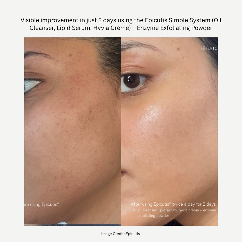 Lipid Serum
