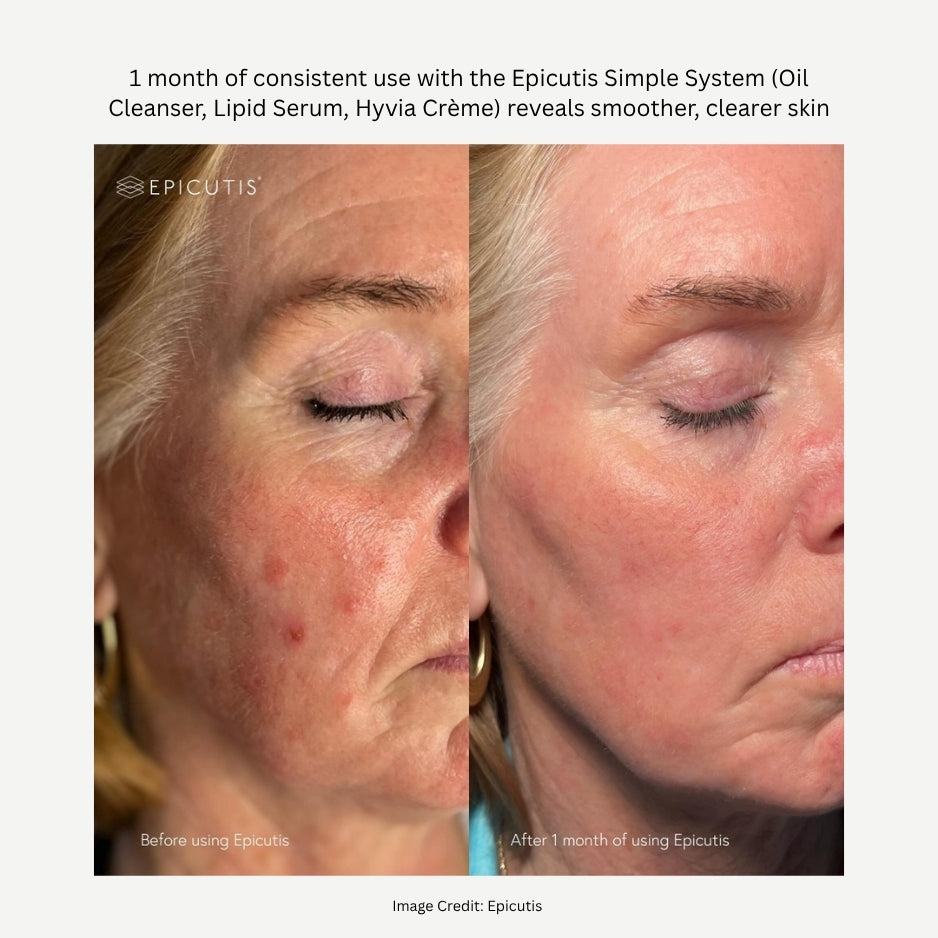 Lipid Serum