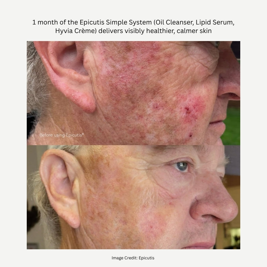Lipid Serum