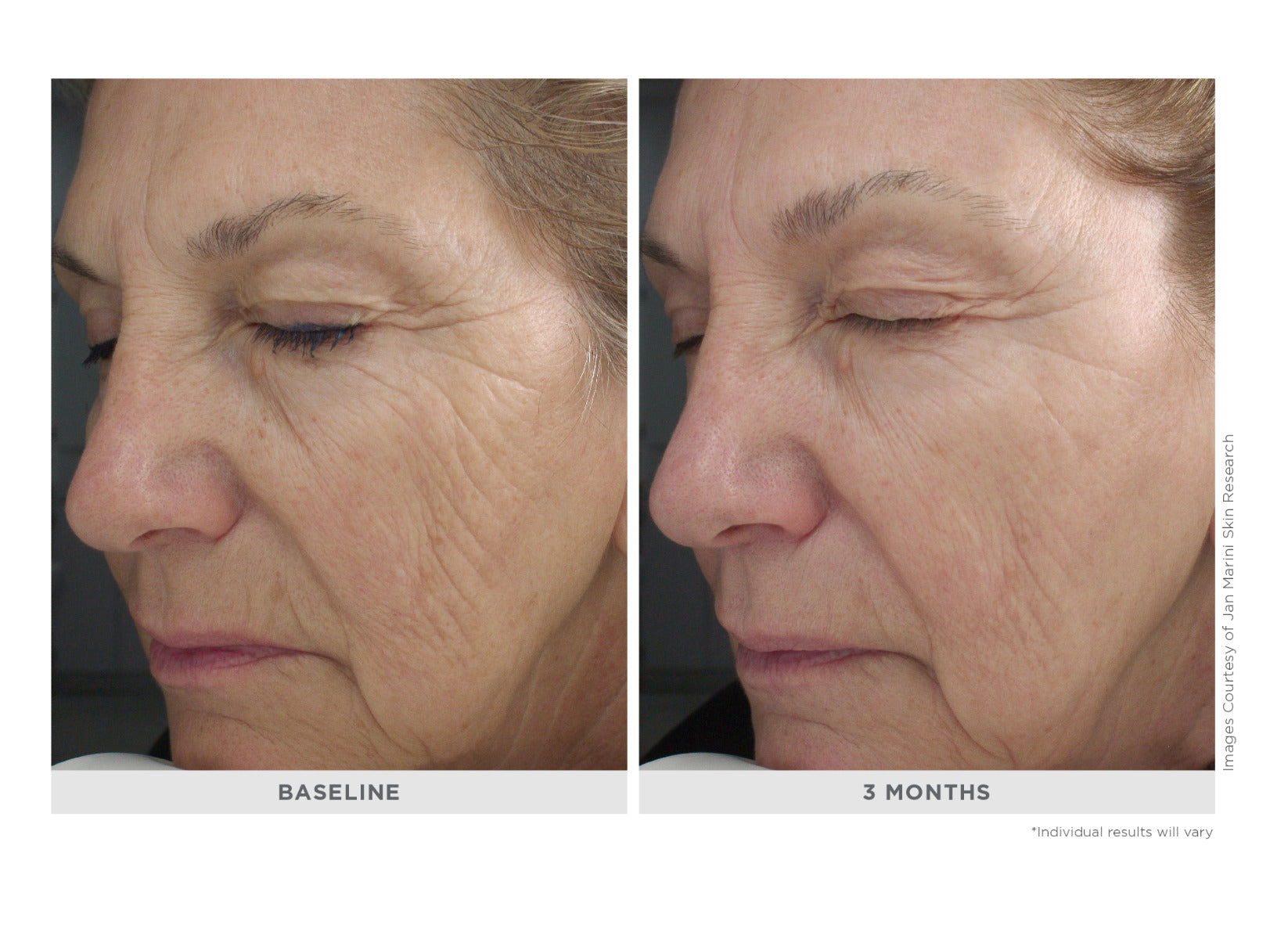Age Intervention™ Retinol Plus