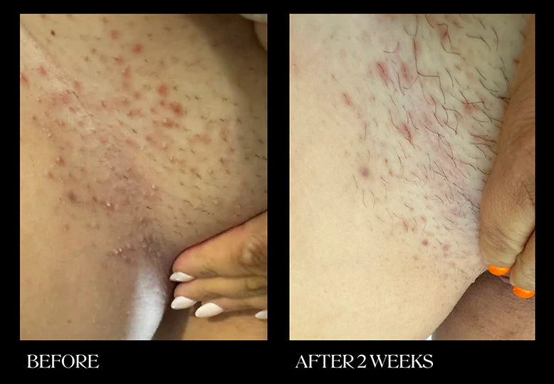 Brightening & Exfoliating Pads