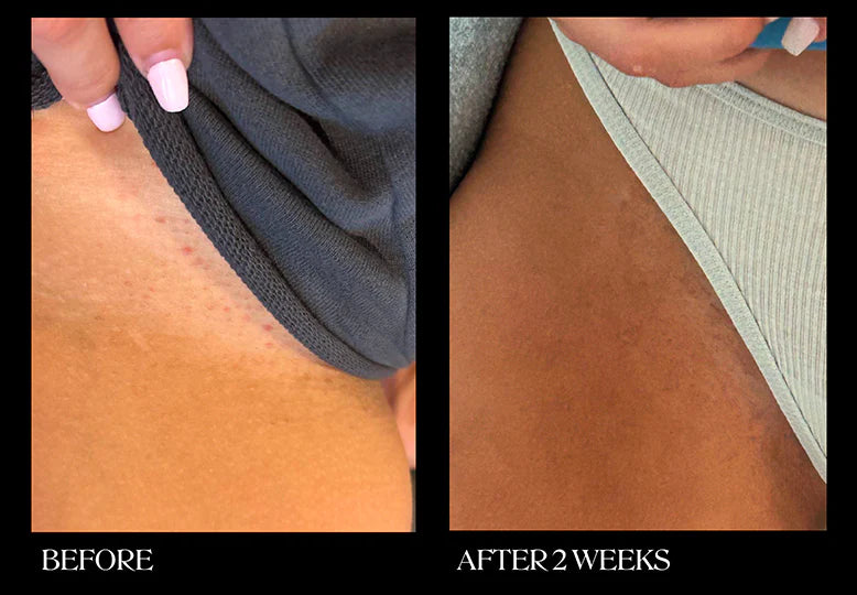 Brightening & Exfoliating Pads