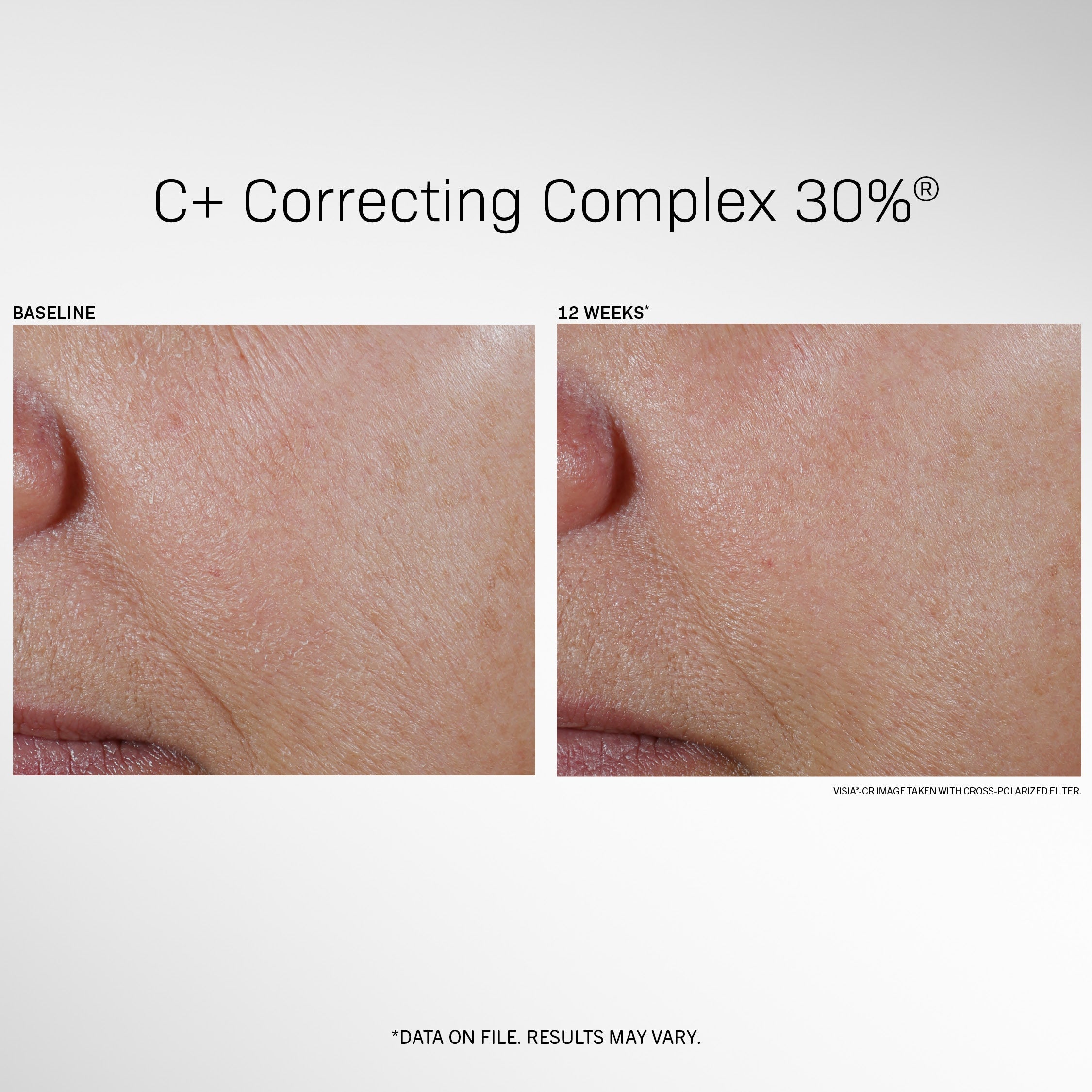 C+ Correcting Complex 30%