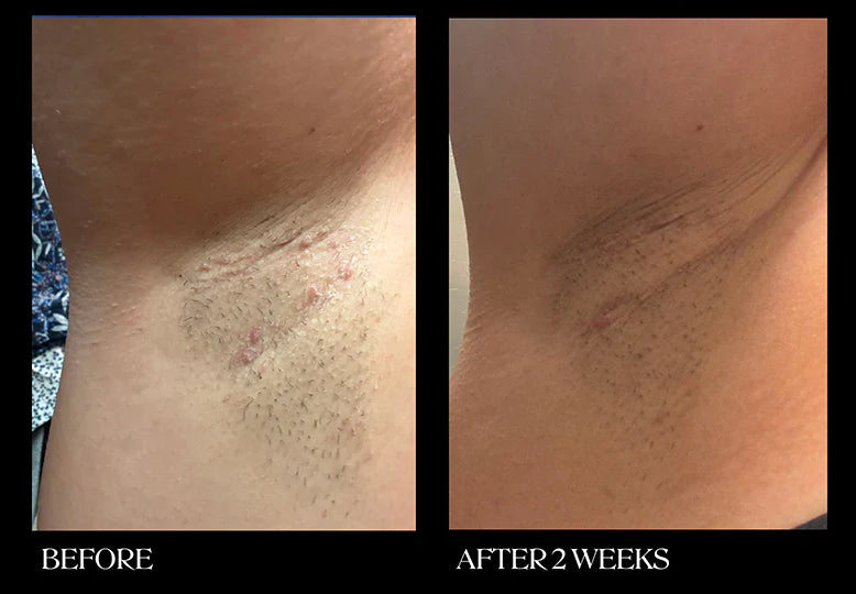 Brightening & Exfoliating Pads