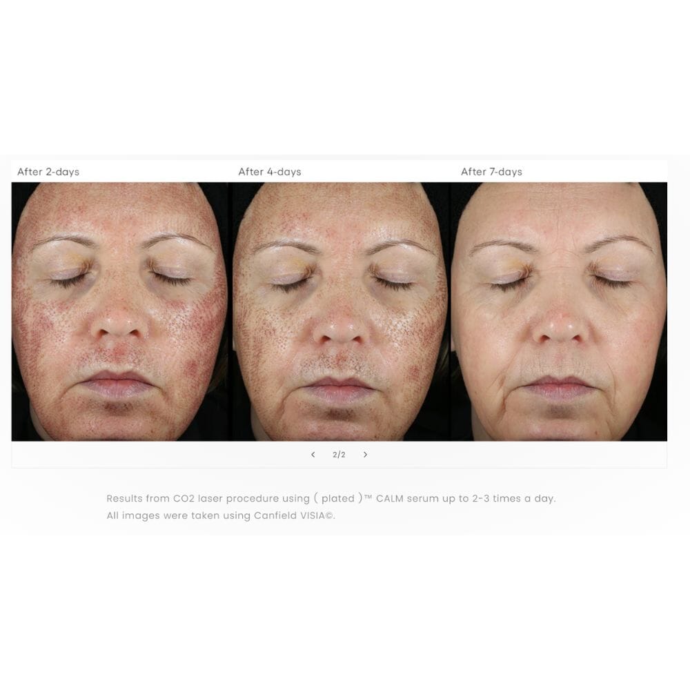CALM Post-Procedure Serum