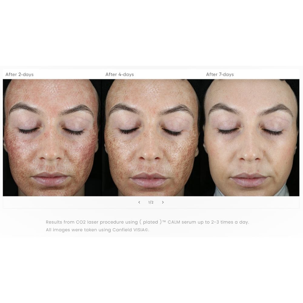 CALM Post-Procedure Serum