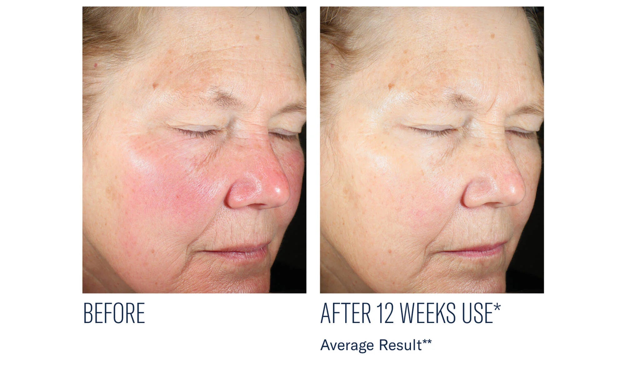 Even Intensive Skin Tone Correcting Serum