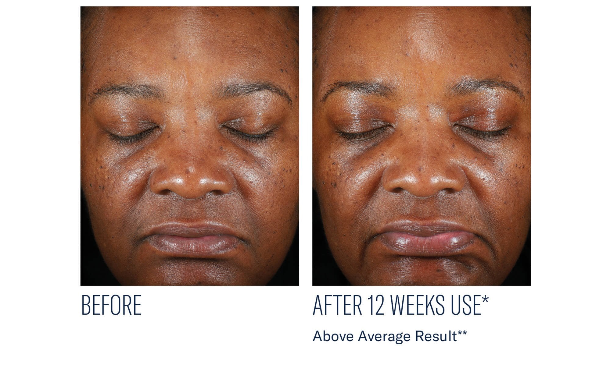 Even Intensive Skin Tone Correcting Serum