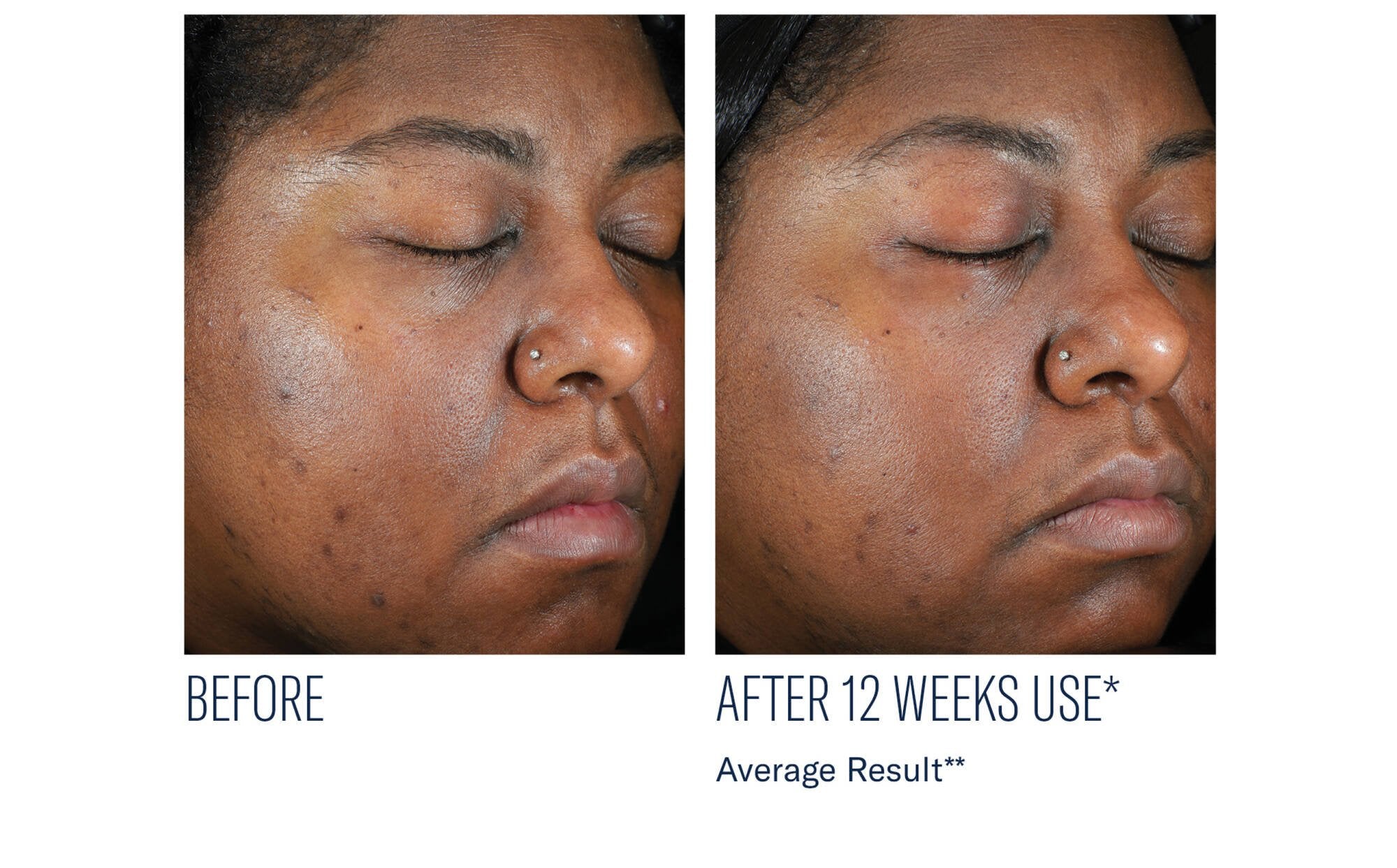 Even Intensive Skin Tone Correcting Serum